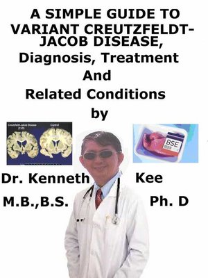 cover image of A Simple Guide to Variant Creutzfeldt-Jakob Disease, Diagnosis, Treatment and Related Conditions